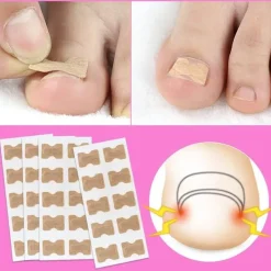 PureGlow Männerpflege|Frauenpflege-Aufkleber zur Korrektur eingewachsener Zehennägel – Behandlung der Zehenausrichtung