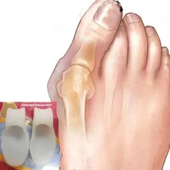 Damen Tranquil Touch Herrenschuhe|Damenschuhe-Orthopädischer Zehentrenner – Fußkorrektor aus Silikongel