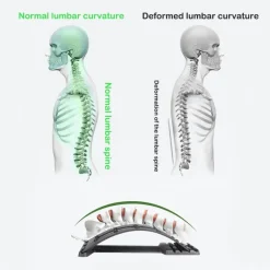 The Relaxation Nook Fitness-Gadgets|Gesundheits- Und Entspannungstools-Rückenschmerzlinderungs-Stretcher - Magisches Wirbelsäulenmassagegerät für Leichtigkeit und Komfort