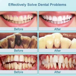 PureGlow Männerpflege|Frauenpflege-Ultraschall-Zahnreiniger-Set – wiederaufladbares Mundpflegesystem