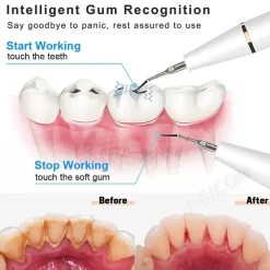 PureGlow Männerpflege|Frauenpflege-Ultraschall-Zahnreiniger-Set – wiederaufladbares Mundpflegesystem