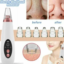 PureGlow Männerpflege|Frauenpflege-Wiederaufladbarer Mitesserentferner - Pure Skin Vacuum Porenreiniger