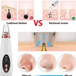 PureGlow Männerpflege|Frauenpflege-Wiederaufladbarer Mitesserentferner - Pure Skin Vacuum Porenreiniger