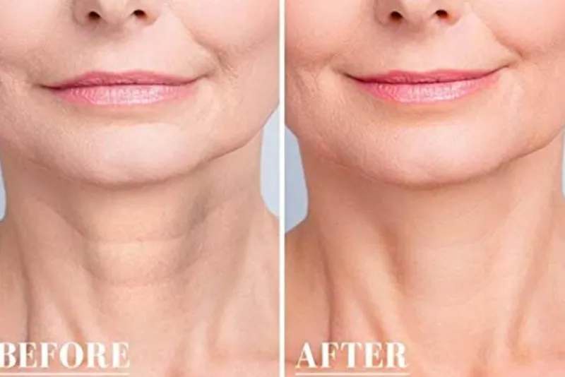 The Relaxation Nook Frauenpflege|Körperpflege-Wiederverwendbare Anti-Falten-Pads aus Silikon – Hautpflegebehandlung