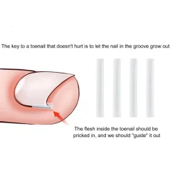 The Relaxation Nook Gesundheits-Gadgets|Gesundheits- Und Entspannungstools-Zehennagel-Stützpolster – Komfortkissen zur Linderung von Zehennagelschmerzen